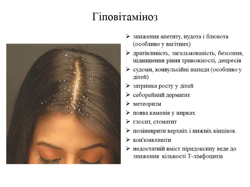 Гіповітаміноз  зниження апетиту, нудота і блювота (особливо у вагітних) дратівливість, загальмованість, безсоння, підвищення